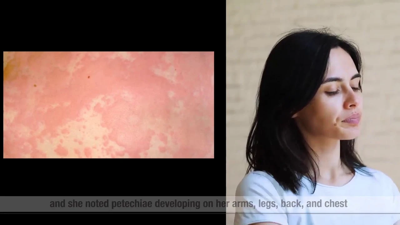 Complications During Artificial Reproductive Treatment: Gufic Bio Sciences